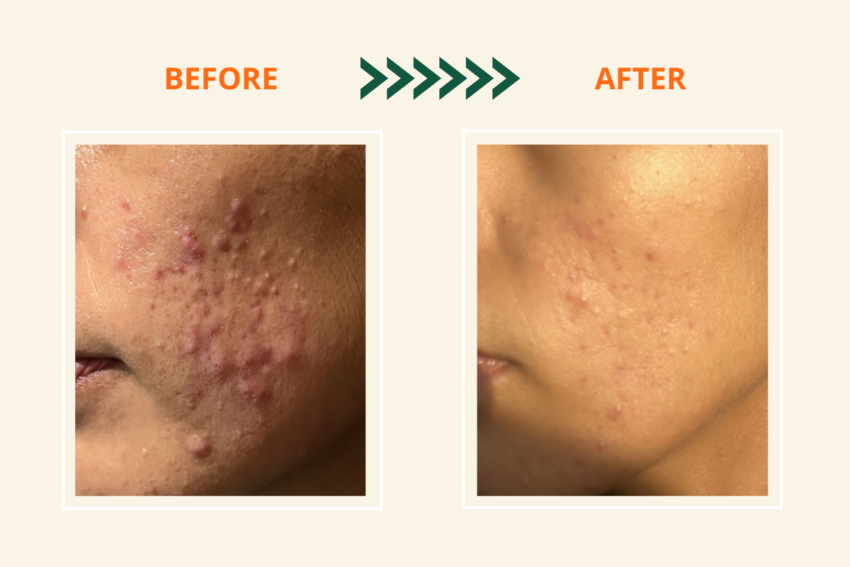 Ultimate S.O.S Youthful Skin Restore Kit