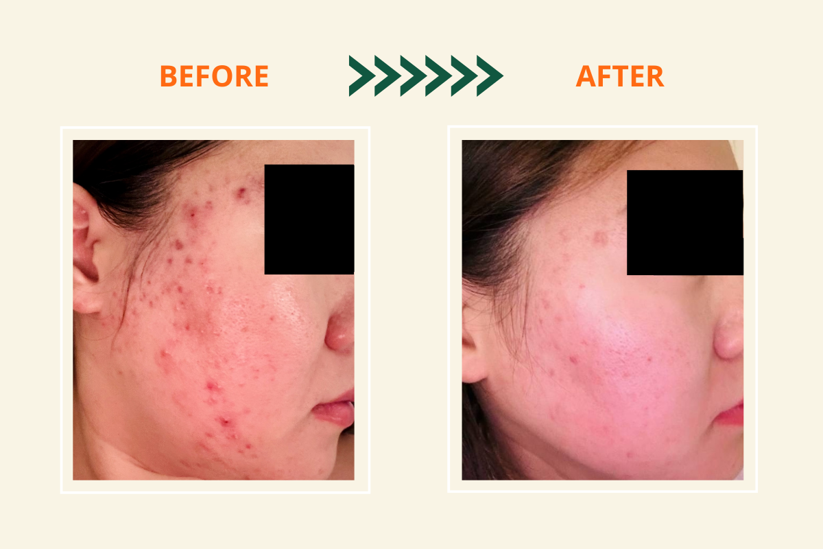Ultimate S.O.S Youthful Skin Restore Kit