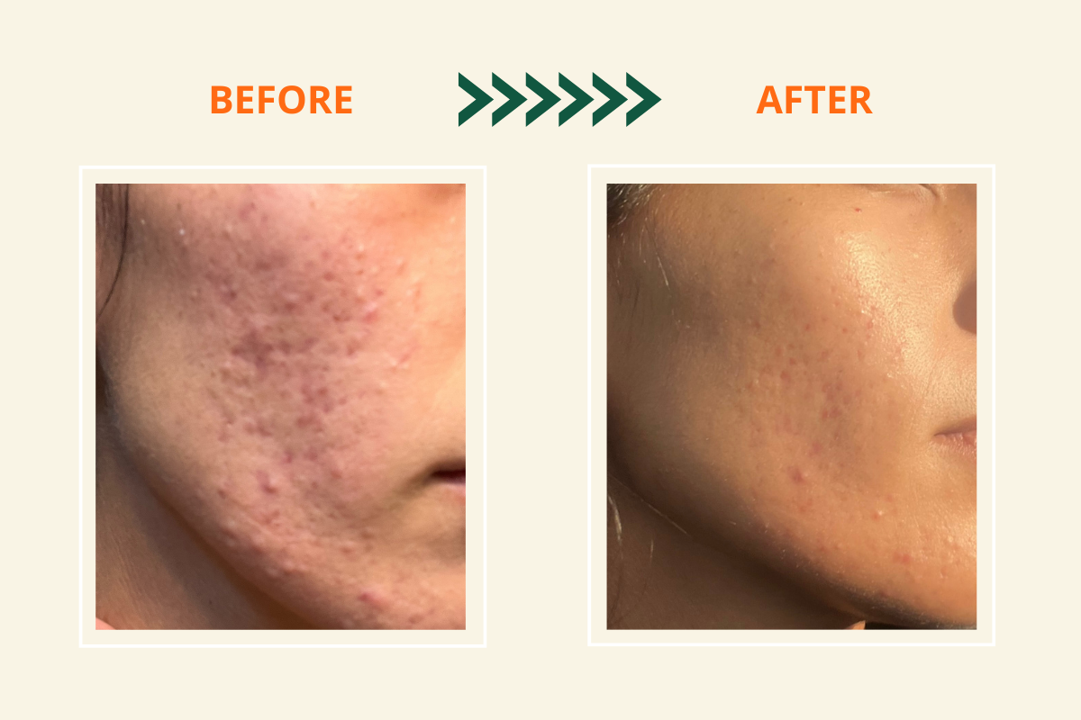 ULTIMATE S.O.S YOUTHFUL SKIN RESTORE MINI KIT